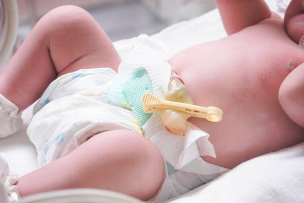 Umbigo do bebê: cuidado e higiene